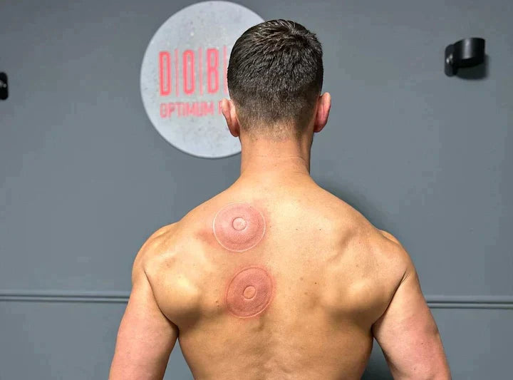 SmartCup Heated Cupping Massager — product view 5