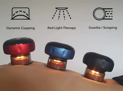 SmartCup Heated Cupping Massager — product view 2